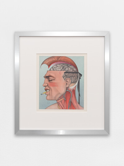 Mel Odom, Brain surgery school, Rolling Stone Magazine, 1988, pencil and dyes on paper, 33 x 25.2 cm (unframed), 43.5 x 40.5 cm (framed), unique - © sans titre